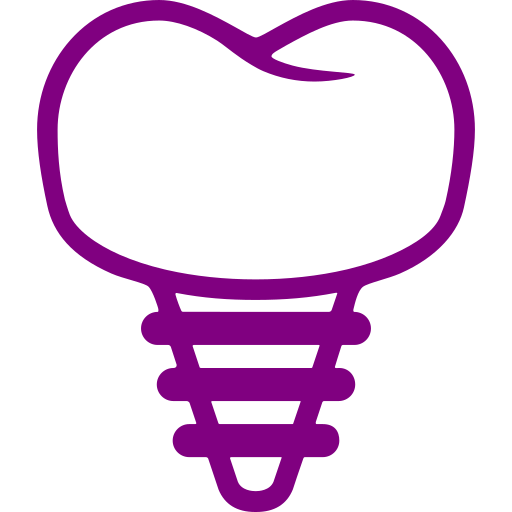 Implantes Dentários